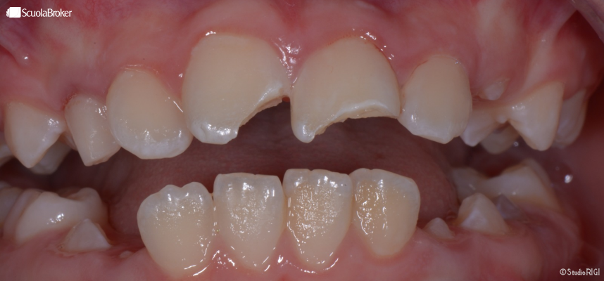 Scherzo a scuola finito male, condannati i genitori